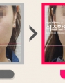입꼬리 안면비대칭 전후사진입니다.
